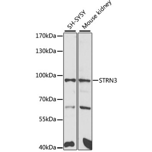 STRN3 Rabbit pAb