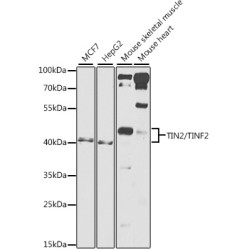 TIN2/TINF2 Rabbit pAb