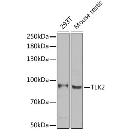 [KO Validated] TLK2 Rabbit pAb