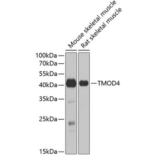 TMOD4 Rabbit pAb