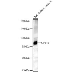 CPT1B Rabbit pAb