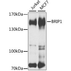 BRIP1 Rabbit pAb