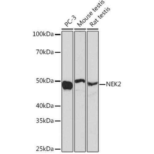 NEK2 Rabbit mAb