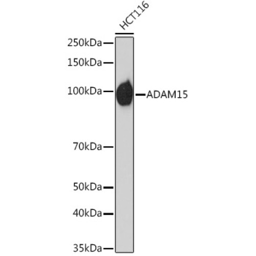 ADAM15 Rabbit mAb