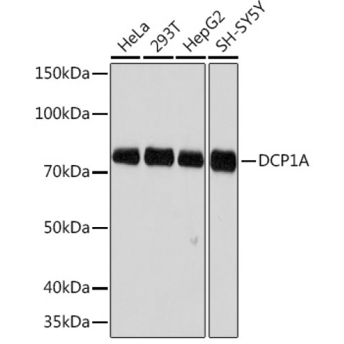 DCP1A Rabbit mAb