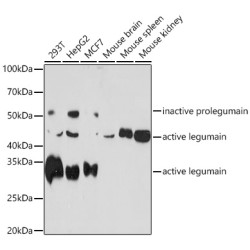 Legumain (LGMN) Rabbit mAb
