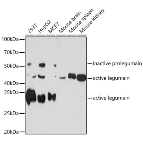 Legumain (LGMN) Rabbit mAb