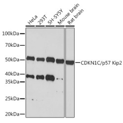 CDKN1C/p57 Kip2 Rabbit mAb