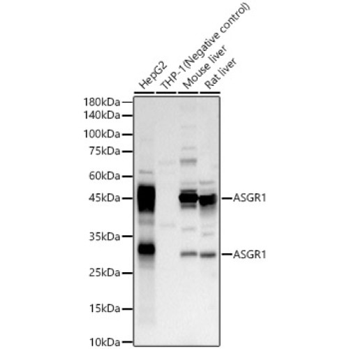 ASGR1 Rabbit pAb