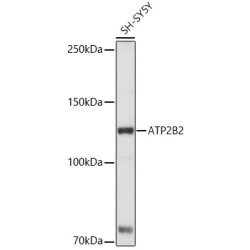 ATP2B2 Rabbit pAb