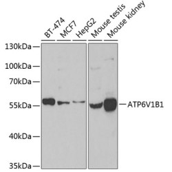 ATP6V1B1 Rabbit pAb