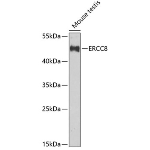 ERCC8 Rabbit pAb
