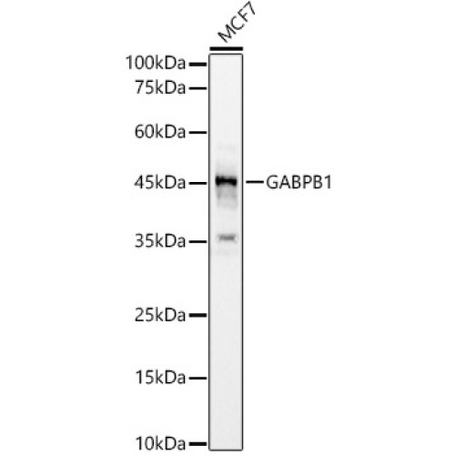 GABPB1 Rabbit pAb