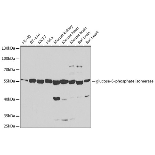 glucose-6-phosphate isomerase Rabbit pAb