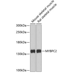 MYBPC2 Rabbit pAb