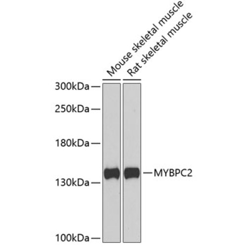 MYBPC2 Rabbit pAb