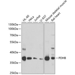 PDHB Rabbit pAb