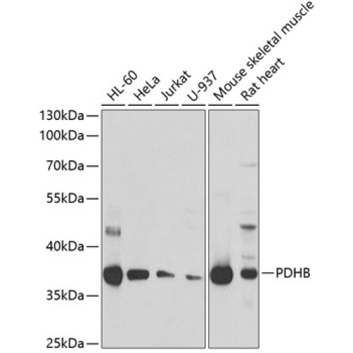 PDHB Rabbit pAb