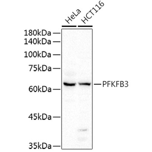 PFKFB3 Rabbit pAb