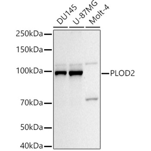 PLOD2/LH2 Rabbit pAb