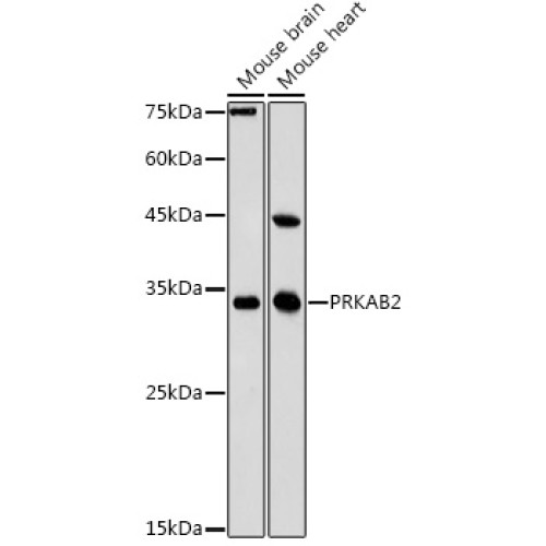 PRKAB2 Rabbit pAb