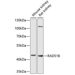 RAD51B Rabbit pAb