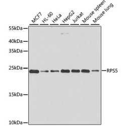 RPS5 Rabbit pAb