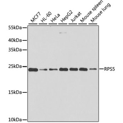 RPS5 Rabbit pAb