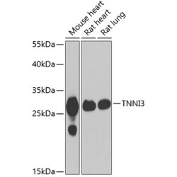 Cardiac Troponin I (TNNI3) Rabbit pAb