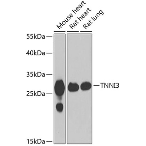 Cardiac Troponin I (TNNI3) Rabbit pAb