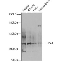 TRPC4 Rabbit pAb