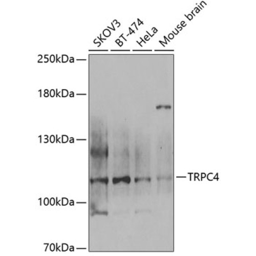 TRPC4 Rabbit pAb