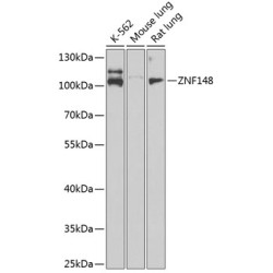 ZNF148 Rabbit pAb