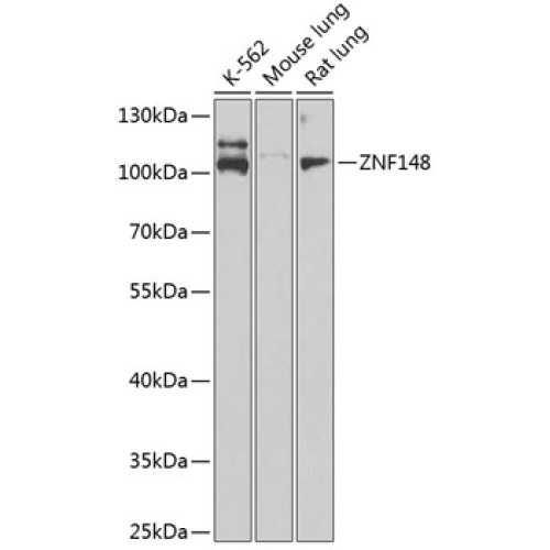 ZNF148 Rabbit pAb