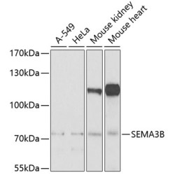 SEMA3B Rabbit pAb