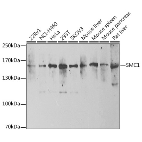 SMC1 Rabbit pAb