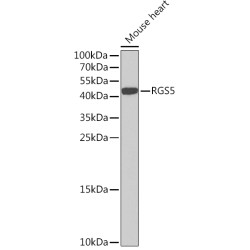 RGS5 Rabbit pAb