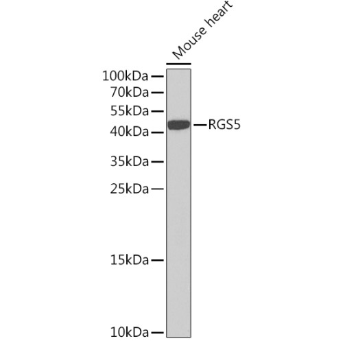 RGS5 Rabbit pAb