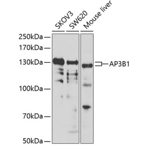 AP3B1 Rabbit pAb
