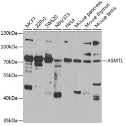 ASMTL Rabbit pAb