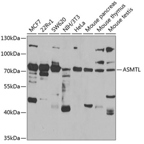 ASMTL Rabbit pAb