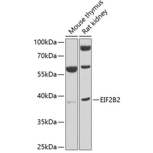 EIF2B2 Rabbit pAb