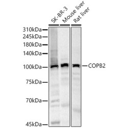 COPB2 Rabbit pAb