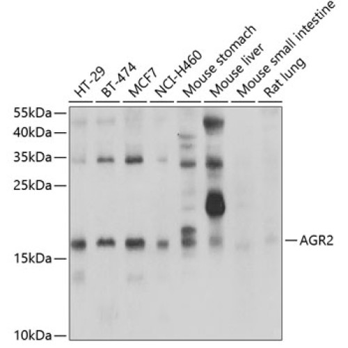 AGR2 Rabbit pAb