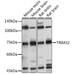 TRIM32 Rabbit pAb