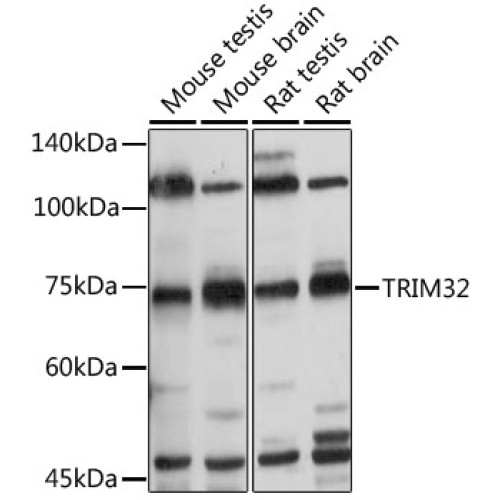 TRIM32 Rabbit pAb