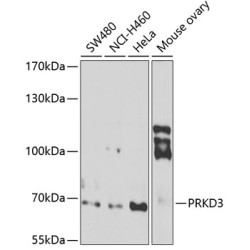 PRKD3 Rabbit pAb