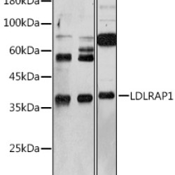 LDLRAP1 Rabbit pAb