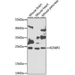 KCNIP2 Rabbit pAb