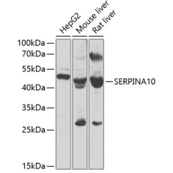 SERPINA10 Rabbit pAb